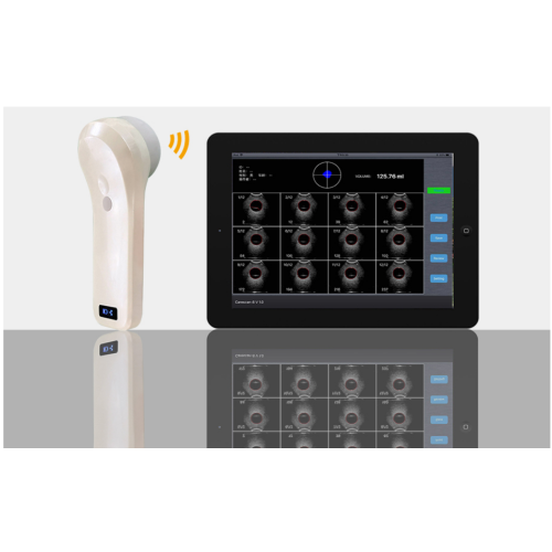 Escáner de ultrasonido de la vejiga inalámbrica